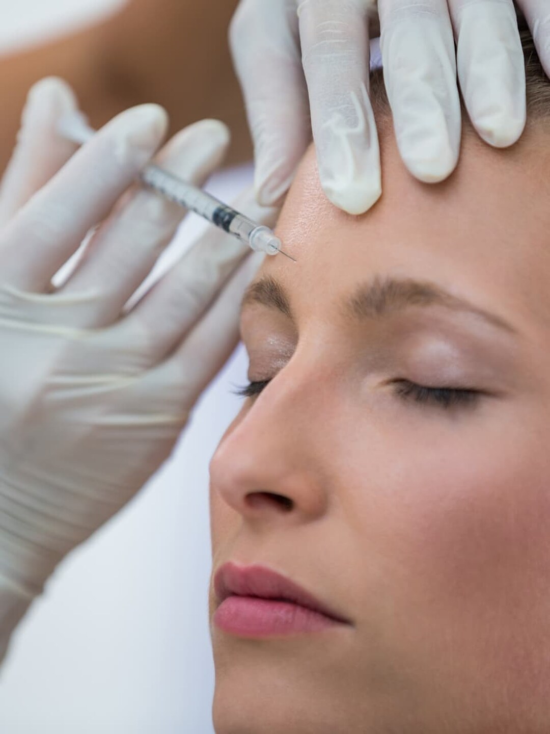 Profissional com luvas brancas aplicando tratamento injetável na testa de cliente, cuidado estético feito no Nix Beauty Salon, no Shopping Palladium, em Curitiba